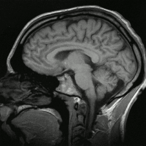 Animated sequence of saggital transections through the human brain.